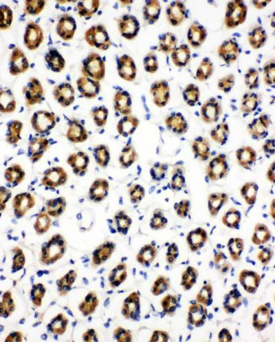 Immunohistochemistry (Formalin/PFA-fixed paraffin-embedded sections) - Anti-SDHC antibody - N-terminal (AB191362)