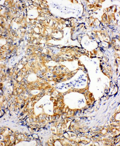 Immunohistochemistry (Formalin/PFA-fixed paraffin-embedded sections) - Anti-SDHC antibody - N-terminal (AB191362)