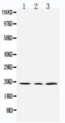 Western blot - Anti-SDHC antibody - N-terminal (AB191362)
