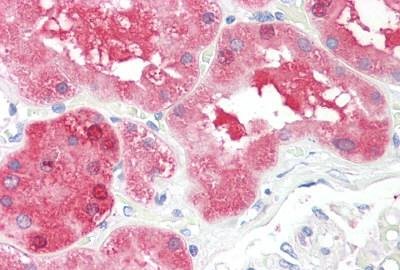 Immunohistochemistry (Formalin/PFA-fixed paraffin-embedded sections) - Anti-SDHD antibody (AB189945)