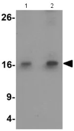 Western blot - Anti-SDHD antibody (AB189945)