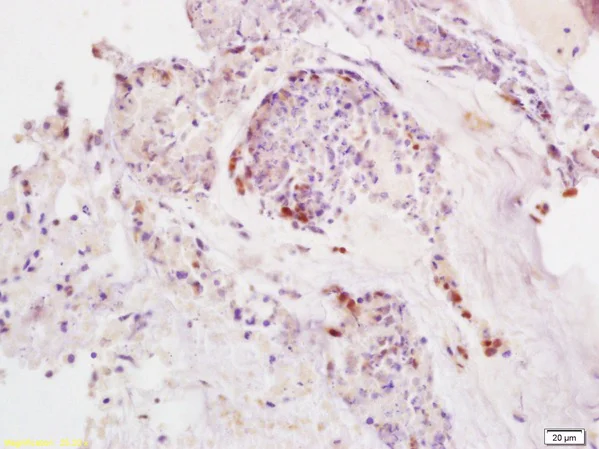 Immunohistochemistry (Formalin/PFA-fixed paraffin-embedded sections) - Anti-SDHD antibody (AB203199)
