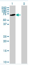 Western blot - Anti-SDPR antibody (AB76867)