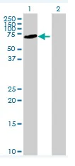 Western blot - Anti-SDPR antibody (AB76867)