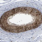 Immunohistochemistry (Formalin/PFA-fixed paraffin-embedded sections) - Anti-SDR-2 antibody (AB121538)