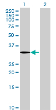 Western blot - Anti-SDS antibody (AB68536), expandable thumbnail