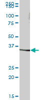 Western blot - Anti-SDS antibody (AB68536), expandable thumbnail