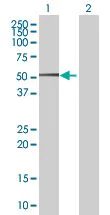 Western blot - SDS3 overexpression 293T lysate (whole cell) (AB94303)