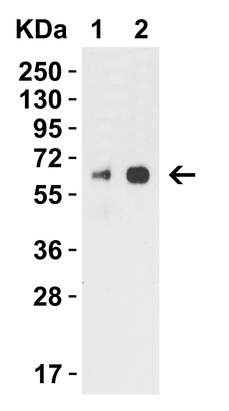 Western blot - Anti-Seasonal and Swine H1N1 Neuraminidase antibody (AB91645)