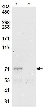 Immunoprecipitation - Anti-SEC10 antibody (AB241472)