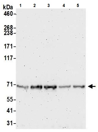 Western blot - Anti-SEC10 antibody (AB241472)