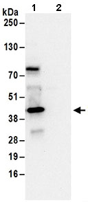 Immunoprecipitation - Anti-SEC13L1 antibody (AB168824)