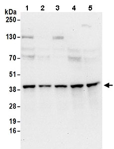Western blot - Anti-SEC13L1 antibody (AB168824)