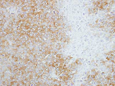 Immunohistochemistry (Formalin/PFA-fixed paraffin-embedded sections) - Anti-SEC14L2/TAP antibody (AB155512), expandable thumbnail