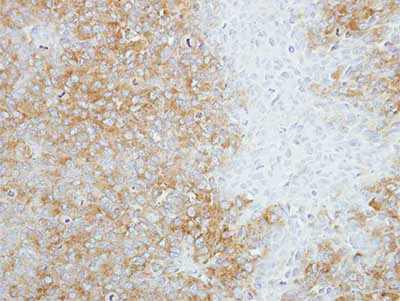 Immunohistochemistry (Formalin/PFA-fixed paraffin-embedded sections) - Anti-SEC14L2/TAP antibody (AB155512)