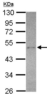 Western blot - Anti-SEC14L2/TAP antibody (AB155512), expandable thumbnail