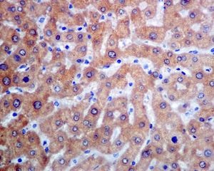 Immunohistochemistry (Formalin/PFA-fixed paraffin-embedded sections) - Anti-SEC14L2/TAP antibody [EPR8612] (AB137013), expandable thumbnail