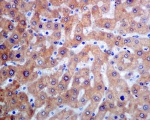 Immunohistochemistry (Formalin/PFA-fixed paraffin-embedded sections) - Anti-SEC14L2/TAP antibody [EPR8612] (AB137013)