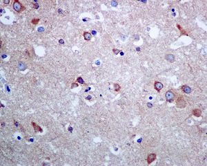 Immunohistochemistry (Formalin/PFA-fixed paraffin-embedded sections) - Anti-SEC14L2/TAP antibody [EPR8612] (AB137013), expandable thumbnail