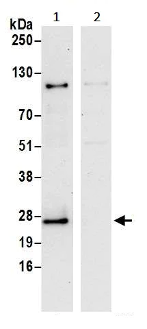 Immunoprecipitation - Anti-SEC22B antibody (AB241585)