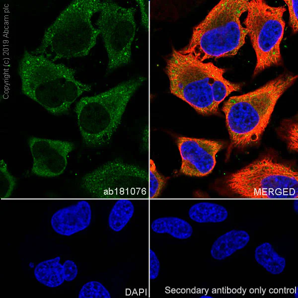 Immunocytochemistry/ Immunofluorescence - Anti-SEC22B antibody [EPR12335] (AB181076)