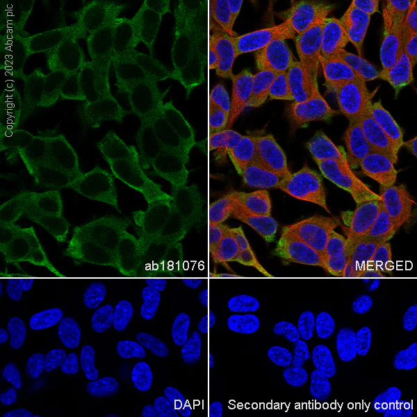 Immunocytochemistry/ Immunofluorescence - Anti-SEC22B antibody [EPR12335] (AB181076)