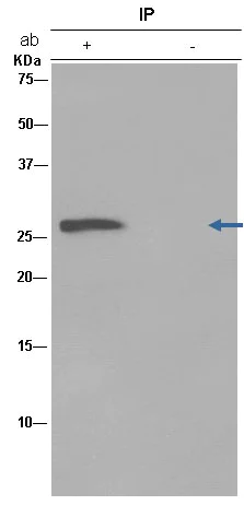 Immunoprecipitation - Anti-SEC22B antibody [EPR12335] (AB181076)