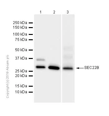 Western blot - Anti-SEC22B antibody [EPR12335] (AB181076)
