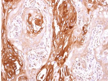 Immunohistochemistry (Formalin/PFA-fixed paraffin-embedded sections) - Anti-SEC23B antibody (AB151258)