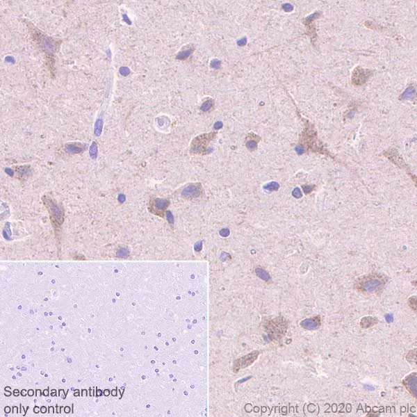 Immunohistochemistry (Formalin/PFA-fixed paraffin-embedded sections) - Anti-SEC23B + SEC23A antibody [EPR22723-102] (AB270750)