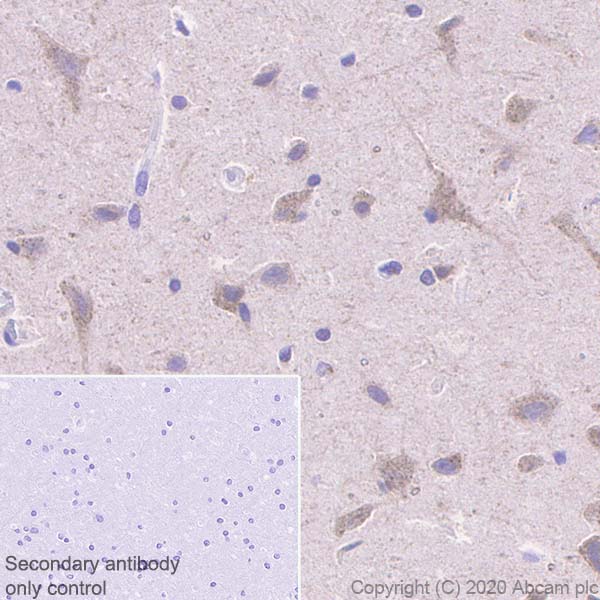 Immunohistochemistry (Formalin/PFA-fixed paraffin-embedded sections) - Anti-SEC23B + SEC23A antibody [EPR22723-102] - BSA and Azide free (AB270757)