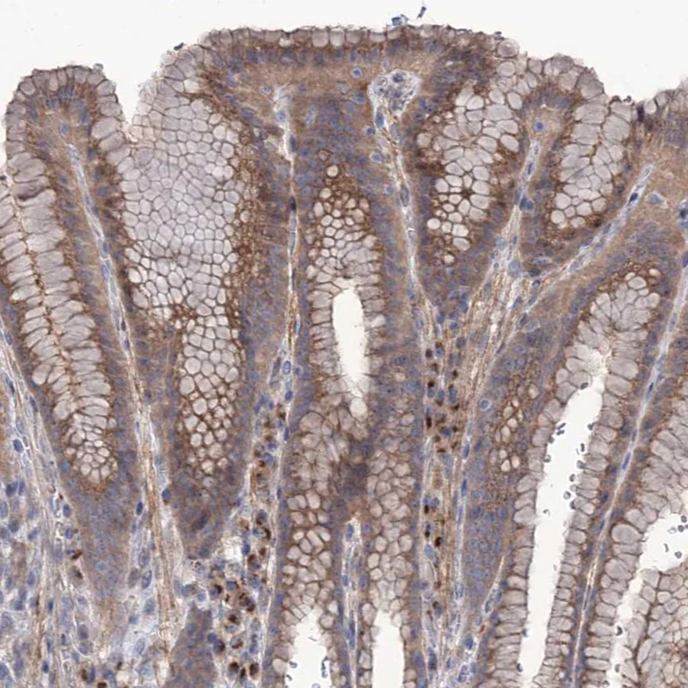 Immunohistochemistry (Formalin/PFA-fixed paraffin-embedded sections) - Anti-SEC24A antibody (AB262869)