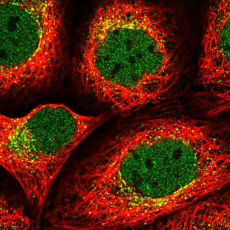 Immunocytochemistry/ Immunofluorescence - Anti-SEC24B antibody (AB122445), expandable thumbnail