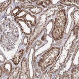 Immunohistochemistry (Formalin/PFA-fixed paraffin-embedded sections) - Anti-SEC24B antibody (AB122445), expandable thumbnail