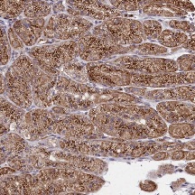 Immunohistochemistry (Formalin/PFA-fixed paraffin-embedded sections) - Anti-Sec24C antibody (AB122633)