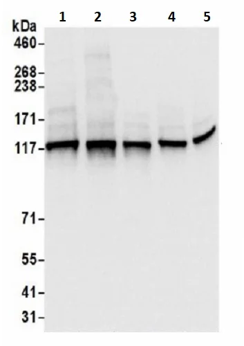 Western blot - Anti-Sec24C antibody (AB241336)
