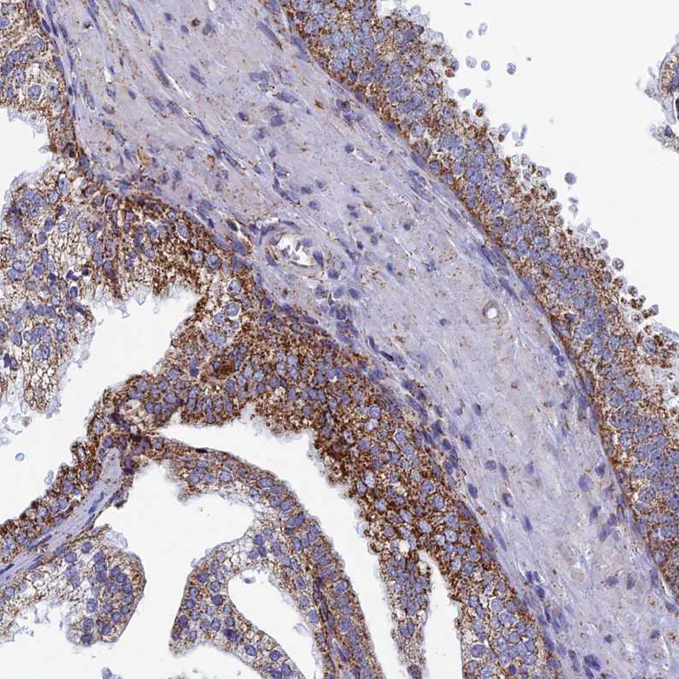 Immunohistochemistry (Formalin/PFA-fixed paraffin-embedded sections) - Anti-SEC24D antibody (AB122732)