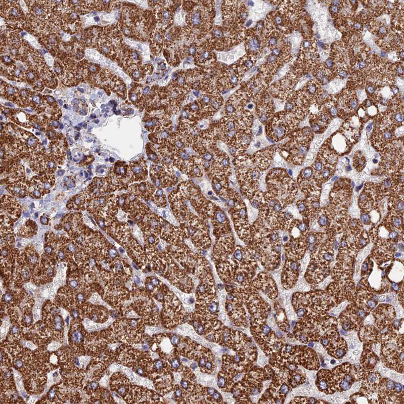 Immunohistochemistry (Formalin/PFA-fixed paraffin-embedded sections) - Anti-SEC24D antibody (AB122732)