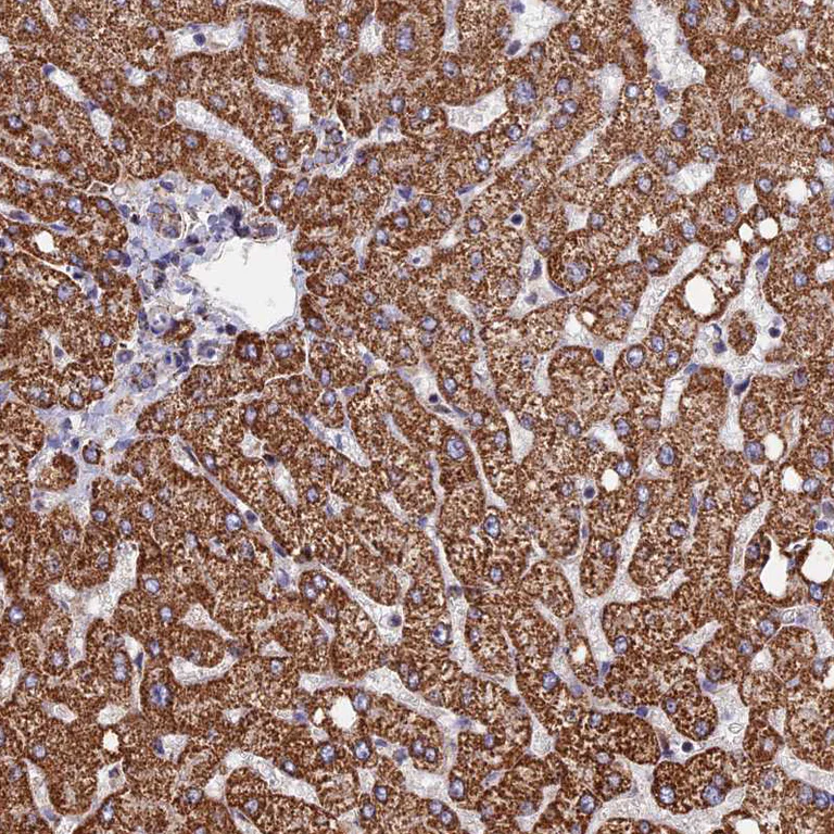 Immunohistochemistry (Formalin/PFA-fixed paraffin-embedded sections) - Anti-SEC24D antibody (AB122732)