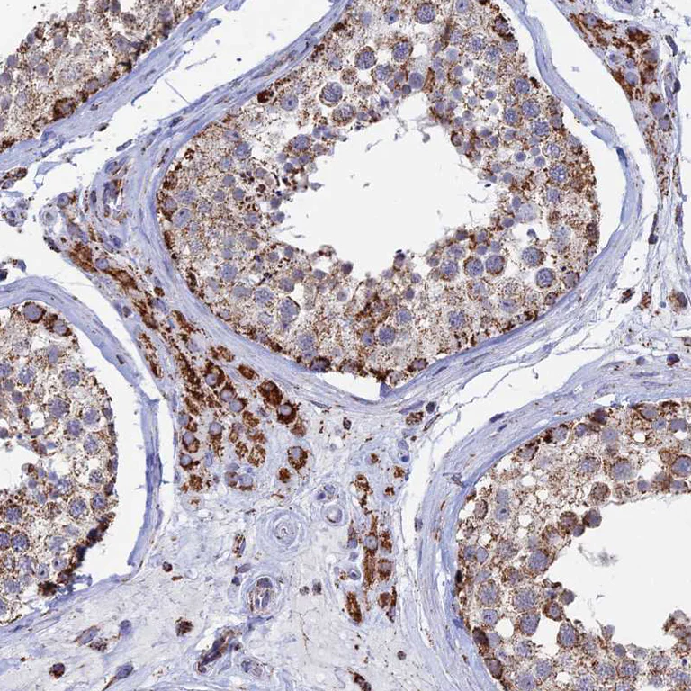 Immunohistochemistry (Formalin/PFA-fixed paraffin-embedded sections) - Anti-SEC24D antibody (AB122732)