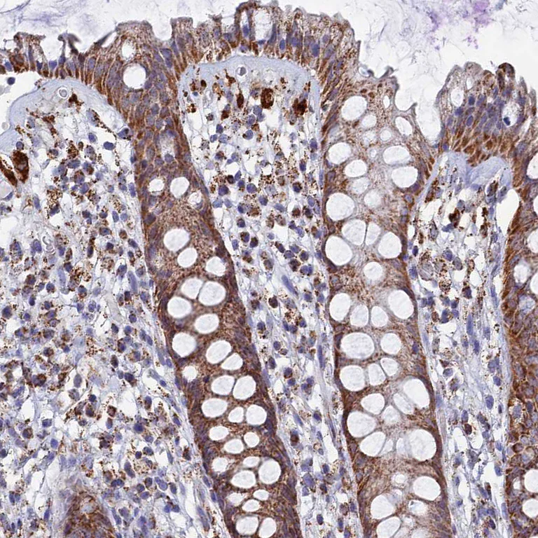 Immunohistochemistry (Formalin/PFA-fixed paraffin-embedded sections) - Anti-SEC24D antibody (AB122732)