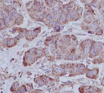 Immunohistochemistry (Formalin/PFA-fixed paraffin-embedded sections) - Anti-SEC61A antibody [EPR14379] (AB183046), expandable thumbnail