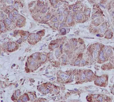 Immunohistochemistry (Formalin/PFA-fixed paraffin-embedded sections) - Anti-SEC61A antibody [EPR14379] - BSA and Azide free (AB240264)