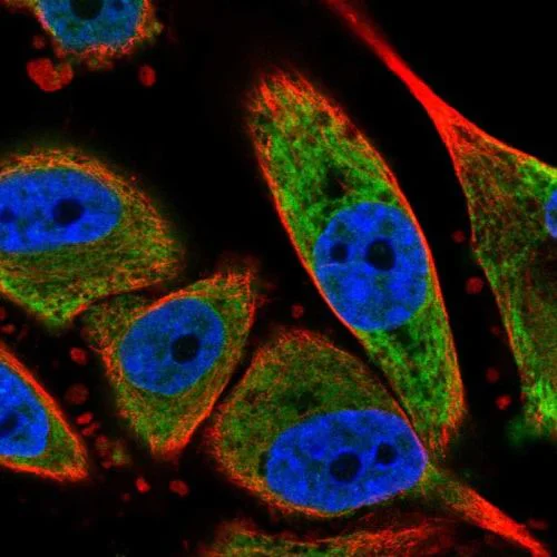 Immunocytochemistry/ Immunofluorescence - Anti-SEC61B antibody (AB244487)