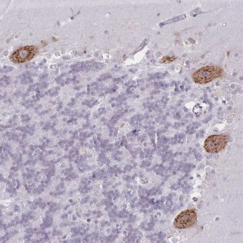 Immunohistochemistry (Formalin/PFA-fixed paraffin-embedded sections) - Anti-SEC61B antibody (AB244487)