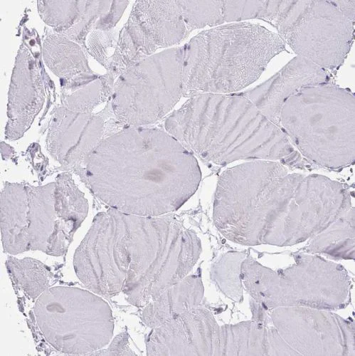 Immunohistochemistry (Formalin/PFA-fixed paraffin-embedded sections) - Anti-SEC61B antibody (AB244487)