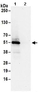 Immunoprecipitation - Anti-SEC62 antibody (AB168843)