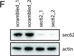 Western blot - Anti-SEC62 antibody (AB168843)