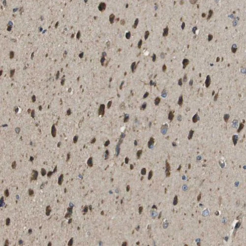 Immunohistochemistry (Formalin/PFA-fixed paraffin-embedded sections) - Anti-SEC62 antibody (AB244335)