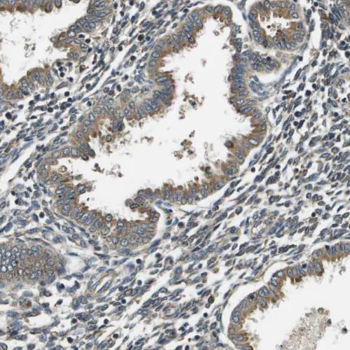 Immunohistochemistry (Formalin/PFA-fixed paraffin-embedded sections) - Anti-SEC62 antibody (AB244335)